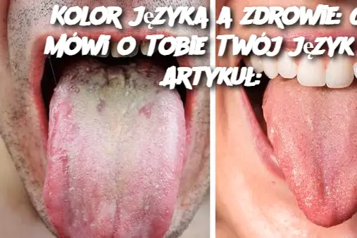 Kolor języka a zdrowie: Co mówi o Tobie Twój język? Artykuł: