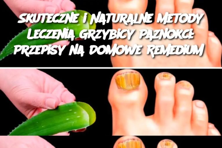 Skuteczne i Naturalne Metody Leczenia Grzybicy Paznokci: Przepisy na Domowe Remediu