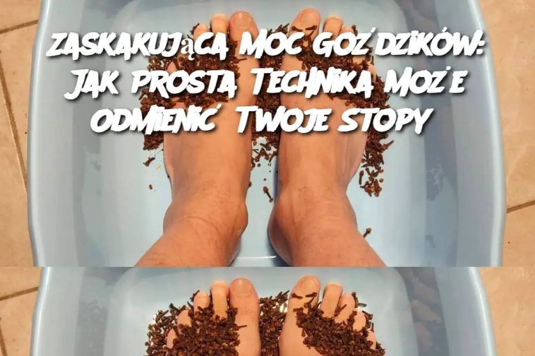 Zaskakująca Moc Goździków: Jak Prosta Technika Może Odmienić Twoje Stopy