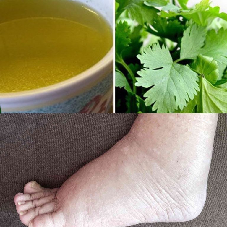 Naturalny napój detoksykujący – pozbądź się nadmiaru wody i poczuj się lżej już po kilku dniach! 💧🍋