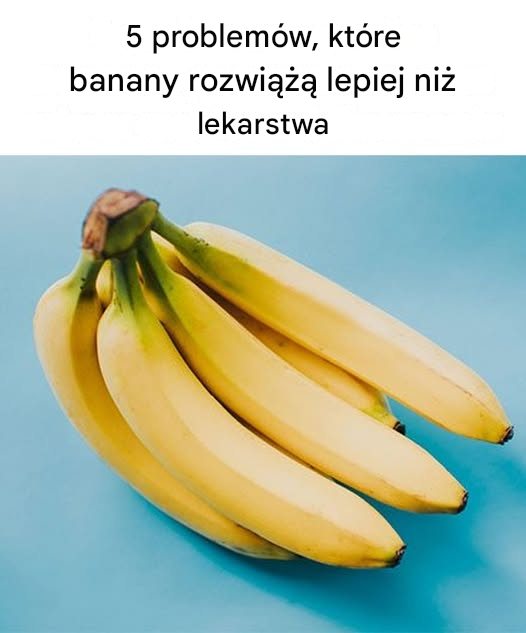 5 problemów, które banany rozwiążą lepiej niż lekarstwa