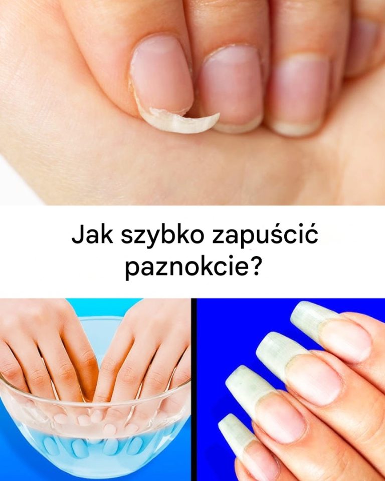 Naturalna kuracja dla dłoni: domowy sposób na szybszy wzrost paznokci