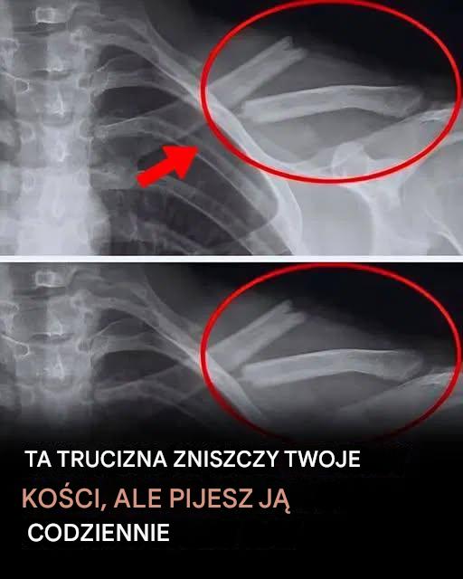 Ten napój zniszczy Twoje kości od środka, ale miliony ludzi piją go każdego dnia