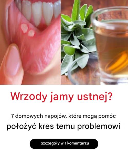 Afty w jamie ustnej? 7 domowych napojów, które pomogą położyć kres temu problemowi