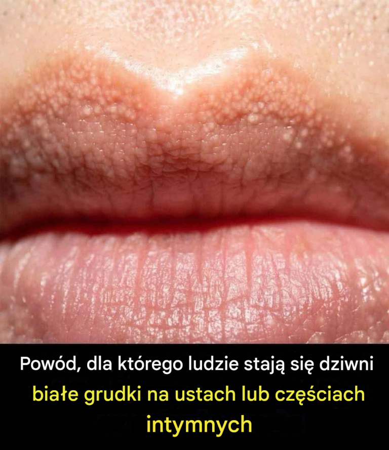 7 oznak zapalenia stawów, których nie powinieneś ignorować