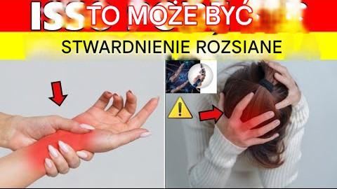 NIE IGNORUJ! 10 wczesnych objawów stwardnienia rozsianego, o których mało kto wie