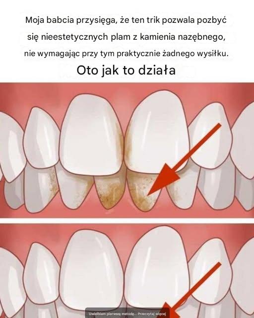 Tytuł: Prosty trik Nany na usuwanie kamienia nazębnego: prosty rozjaśniacz uśmiechu, który naprawdę działa