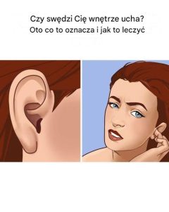 Moje swędzą cały czas! Musiałam to zobaczyć!