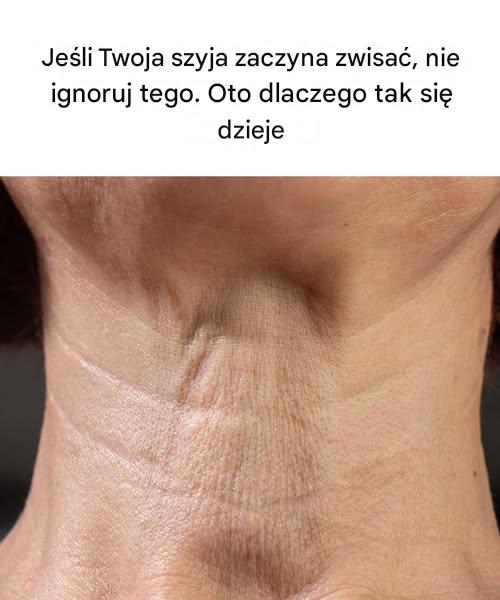Jeśli Twoja szyja zaczyna zwisać, nie ignoruj ​​tego. Oto dlaczego tak się dzieje